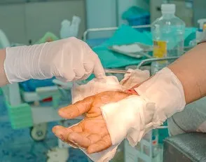ATENCIÓN A PACIENTES QUEMADOS