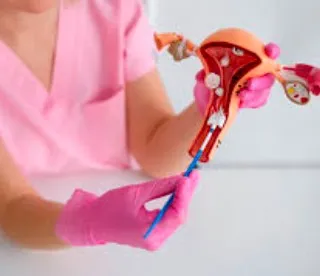 DETECCION ALTERACIONES CUELLO UTERINO TOMA E INTERPRETACION DE CITOLOGIA